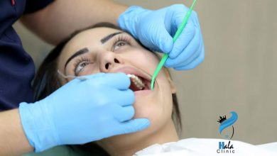 صورة تقديم خدمات طب الأسنان لـ 5 مليون مواطن بالعيادات الثابتة والمتنقلة