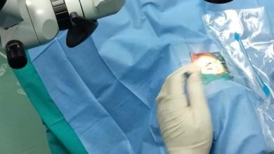 صورة توفير أجهزة «فاكو» بقوافل طب العيون لسرعة إنهاء قوائم الانتظار