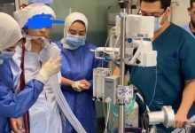 صورة فريق (الإيكمو) بطوارئ قصر العيني ينقذ سيدة حامل من موت محقق ويعيدها للحياة