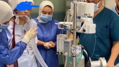 صورة فريق (الإيكمو) بطوارئ قصر العيني ينقذ سيدة حامل من موت محقق ويعيدها للحياة