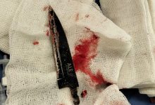 صورة فريق قصر العيني ينجح في استخراج آلة حادة مستقرة داخل المخ