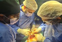 صورة إنجاز طبي جديد بصدر العباسية.. جراحة دقيقة تعيد كفاءة الرئة لمريض