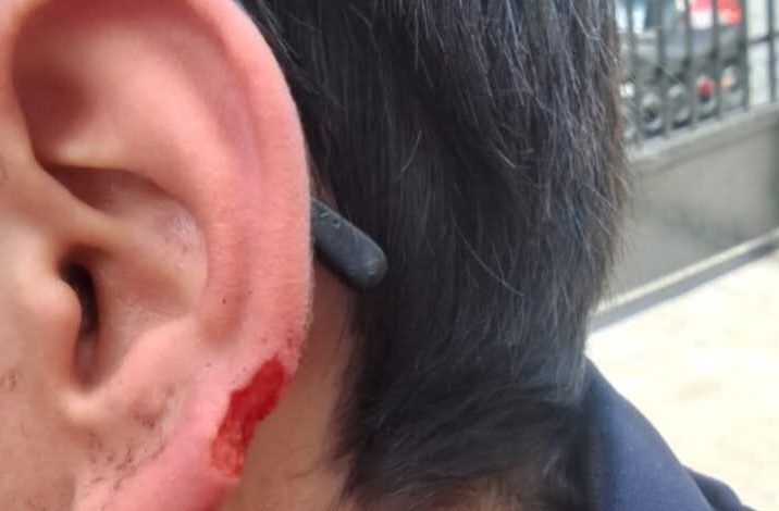 طالب يفقد جزءًا من أذنه إثر اعتداء داخل مدرسة بالإسكندرية