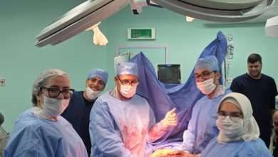 صورة ورم ضخم يهدد حياة مريضة و”زايد التخصصى” ينجح فى انقاذها