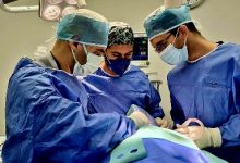 صورة منذ انطلاق احتفالات عيد الأضحى المبارك.. إجراء 550 عملية جراحية